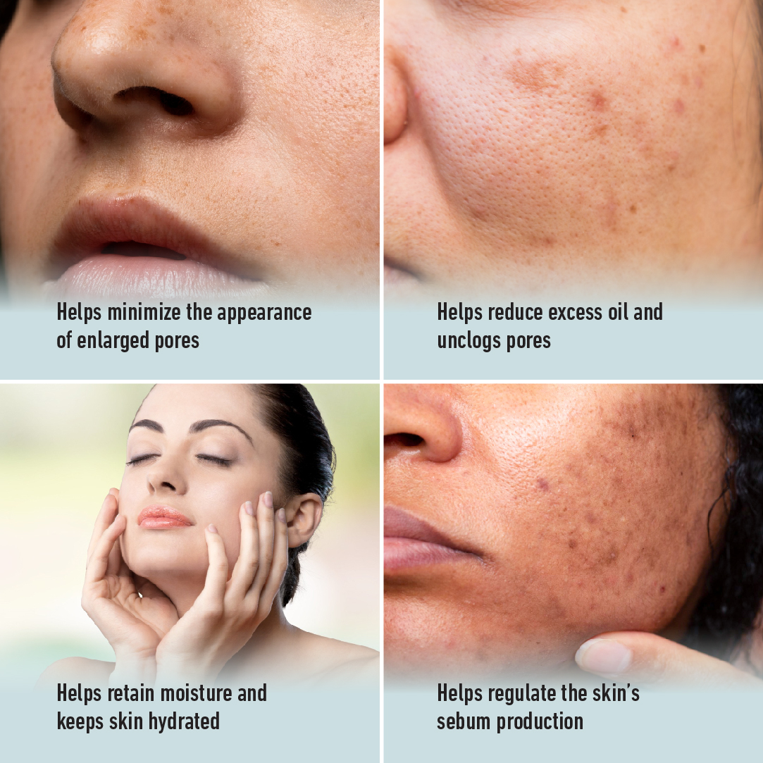 Skin Cafe My Therapist Pore Perfect Serum 30mL - Image 7