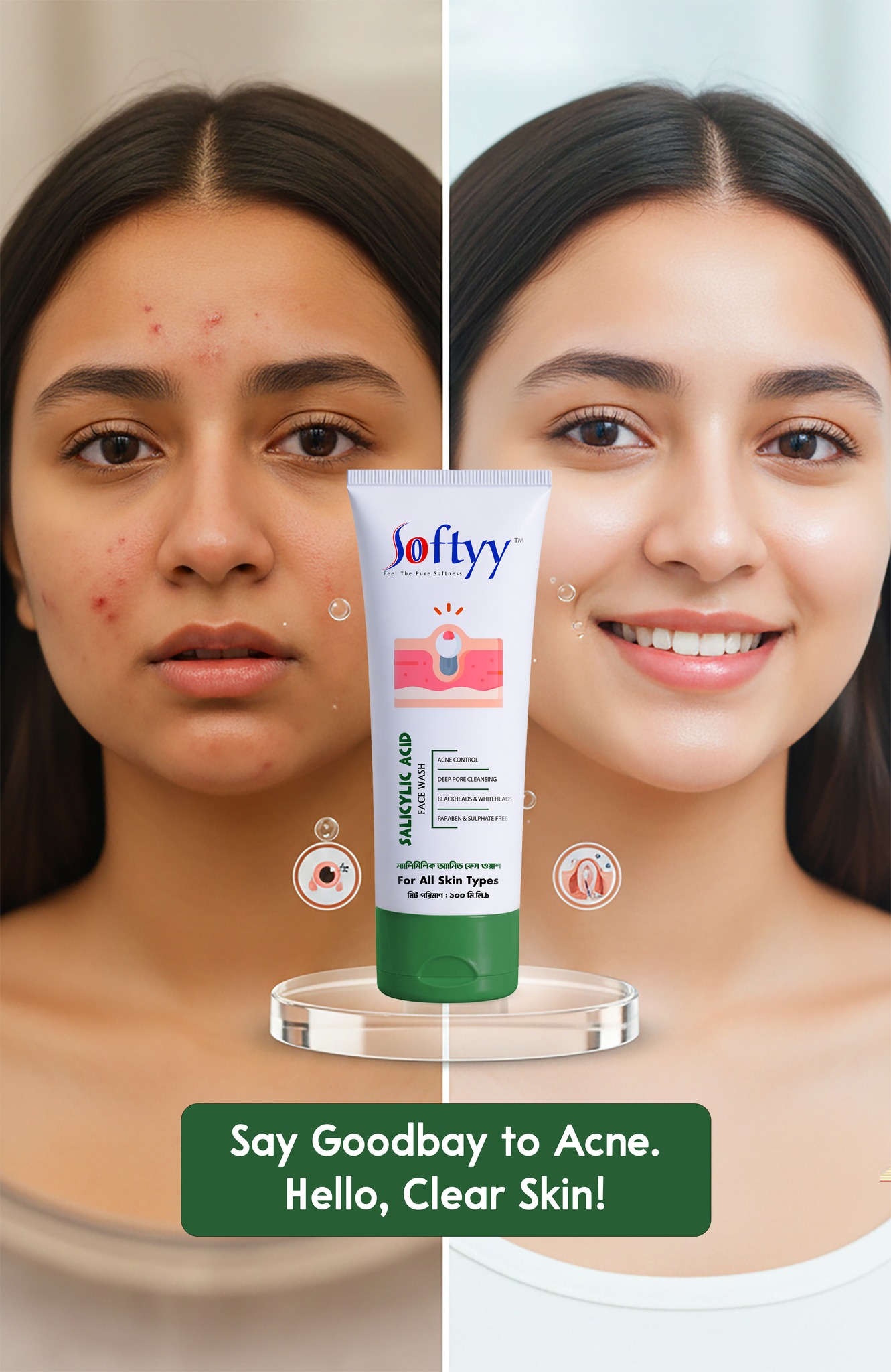 Softyy Salicylic Acid Face Wash 100mL - Image 2